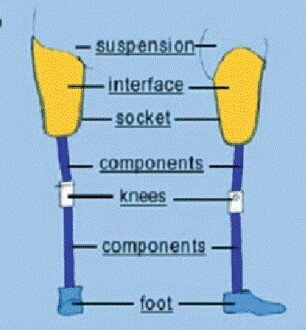 4 Basic Components of Prosthetic Legs